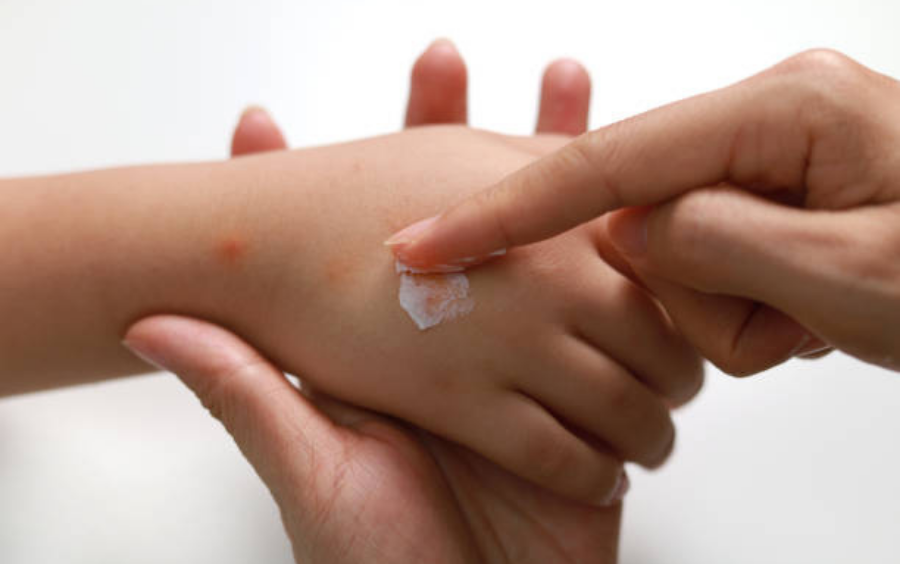 Sat-khuan-vet-thuong-con-trung-can